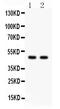PTOV1 Extended AT-Hook Containing Adaptor Protein antibody, RP1087, Boster Biological Technology, Western Blot image 