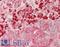Galactosidase Alpha antibody, LS-B13913, Lifespan Biosciences, Immunohistochemistry paraffin image 