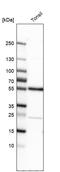 Methyltransferase Like 4 antibody, PA5-59049, Invitrogen Antibodies, Western Blot image 