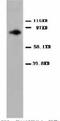 Protein Kinase C Alpha antibody, LS-C171822, Lifespan Biosciences, Western Blot image 