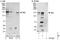 Inhibitor Of Bruton Tyrosine Kinase antibody, NBP1-50033, Novus Biologicals, Western Blot image 