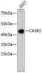 Caspase 2 antibody, 13-794, ProSci, Western Blot image 