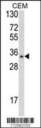 Developmental Pluripotency Associated 4 antibody, 57-700, ProSci, Western Blot image 