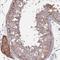Zinc Finger FYVE-Type Containing 28 antibody, NBP2-49262, Novus Biologicals, Immunohistochemistry frozen image 