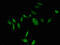 Thymidylate Synthetase antibody, CSB-PA025393LA01HU, Cusabio, Immunofluorescence image 