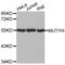 MutY DNA Glycosylase antibody, LS-C332024, Lifespan Biosciences, Western Blot image 