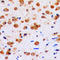 Akt antibody, LS-C351852, Lifespan Biosciences, Immunohistochemistry frozen image 