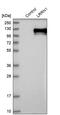 Leucine Rich Repeat Neuronal 1 antibody, PA5-52786, Invitrogen Antibodies, Western Blot image 