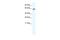 TATA-Box Binding Protein Associated Factor, RNA Polymerase I Subunit B antibody, A06986, Boster Biological Technology, Western Blot image 