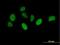 Nucleoporin 43 antibody, H00348995-B01P, Novus Biologicals, Immunocytochemistry image 