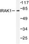 Interleukin 1 Receptor Associated Kinase 1 antibody, LS-C176416, Lifespan Biosciences, Western Blot image 