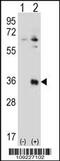 Testis Specific Serine Kinase 6 antibody, 56-442, ProSci, Western Blot image 