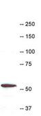 Coronin 1A antibody, PA1-46202, Invitrogen Antibodies, Western Blot image 