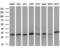Succinate Dehydrogenase Complex Iron Sulfur Subunit B antibody, MA5-26937, Invitrogen Antibodies, Western Blot image 