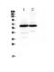 Synaptotagmin 1 antibody, PA5-80089, Invitrogen Antibodies, Western Blot image 