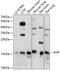 Arginine Vasopressin antibody, 16-893, ProSci, Western Blot image 
