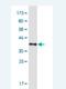 Heat Shock Protein Family A (Hsp70) Member 6 antibody, H00003310-M01-100ug, Novus Biologicals, Western Blot image 
