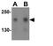 TSC Complex Subunit 2 antibody, GTX31286, GeneTex, Western Blot image 