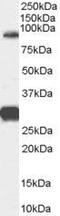 Forkhead Box P2 antibody, PA5-18615, Invitrogen Antibodies, Western Blot image 