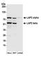 LAP2 antibody, A304-838A, Bethyl Labs, Western Blot image 
