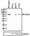 Estrogen Receptor 1 antibody, MA3-310, Invitrogen Antibodies, Western Blot image 