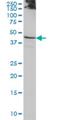 Actin Like 7B antibody, H00010880-M01, Novus Biologicals, Western Blot image 