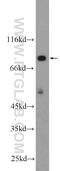 HECT Domain E3 Ubiquitin Protein Ligase 2 antibody, 25351-1-AP, Proteintech Group, Western Blot image 