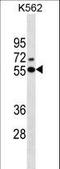 Estrogen Receptor 2 antibody, LS-C159572, Lifespan Biosciences, Western Blot image 