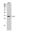 Forkhead Box E3 antibody, A05314-1, Boster Biological Technology, Western Blot image 