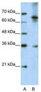 Wnt Family Member 9B antibody, TA344061, Origene, Western Blot image 