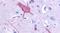 Glutamate Metabotropic Receptor 1 antibody, PA5-33813, Invitrogen Antibodies, Immunohistochemistry paraffin image 