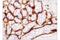 Cytochrome P450 Family 19 Subfamily A Member 1 antibody, 14528S, Cell Signaling Technology, Immunohistochemistry paraffin image 