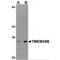 Transmembrane Protein 38B antibody, MBS150815, MyBioSource, Western Blot image 