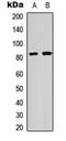 Heat Shock Transcription Factor 1 antibody, LS-C356117, Lifespan Biosciences, Western Blot image 