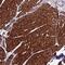 Clustered Mitochondria Homolog antibody, NBP1-91866, Novus Biologicals, Immunohistochemistry paraffin image 