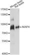 HI antibody, A14813, ABclonal Technology, Western Blot image 