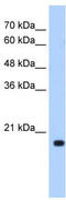 DCTP Pyrophosphatase 1 antibody, TA339362, Origene, Western Blot image 