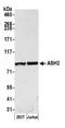 SET1 antibody, NB600-250, Novus Biologicals, Western Blot image 