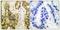 Galectin 3 antibody, LS-C825949, Lifespan Biosciences, Immunohistochemistry paraffin image 