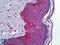 Patatin Like Phospholipase Domain Containing 3 antibody, LS-B5900, Lifespan Biosciences, Immunohistochemistry paraffin image 