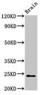 NADH:Ubiquinone Oxidoreductase Core Subunit S8 antibody, LS-C670760, Lifespan Biosciences, Western Blot image 