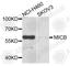 MHC Class I Polypeptide-Related Sequence B antibody, A9802, ABclonal Technology, Western Blot image 