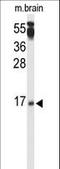 Protein Phosphatase 3 Regulatory Subunit B, Beta antibody, LS-C162093, Lifespan Biosciences, Western Blot image 