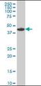 MAP kinase-interacting serine/threonine-protein kinase 1 antibody, orb94675, Biorbyt, Western Blot image 