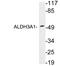 Aldehyde Dehydrogenase 3 Family Member A1 antibody, LS-C199766, Lifespan Biosciences, Western Blot image 