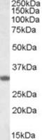 Four And A Half LIM Domains 3 antibody, NBP1-26395, Novus Biologicals, Western Blot image 