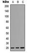 TNF Receptor Superfamily Member 17 antibody, LS-C354317, Lifespan Biosciences, Western Blot image 