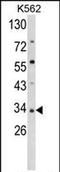 Secreted Frizzled Related Protein 5 antibody, PA5-72510, Invitrogen Antibodies, Western Blot image 