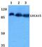 RNA Binding Motif Protein 5 antibody, PA5-36311, Invitrogen Antibodies, Western Blot image 