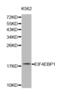 Eukaryotic Translation Initiation Factor 4E Binding Protein 1 antibody, abx001160, Abbexa, Western Blot image 